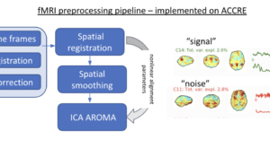 Investigating fMRI Preprocessing Variations: Multi-echo ICA vs. Conventional Preprocessing (DSI-SRP)